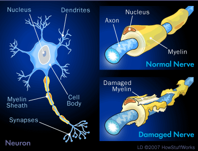  How MS Works