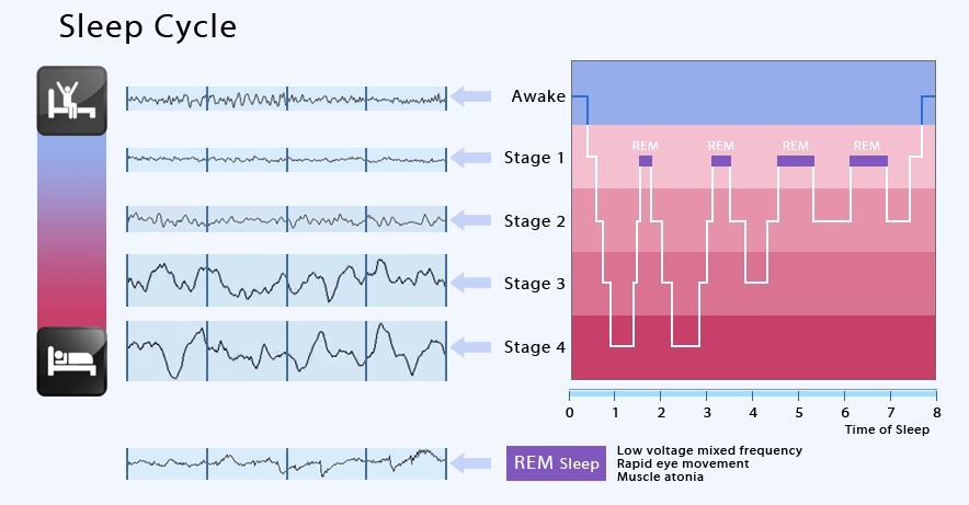 Sleep Cycle 