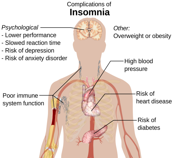 Electroencephalography